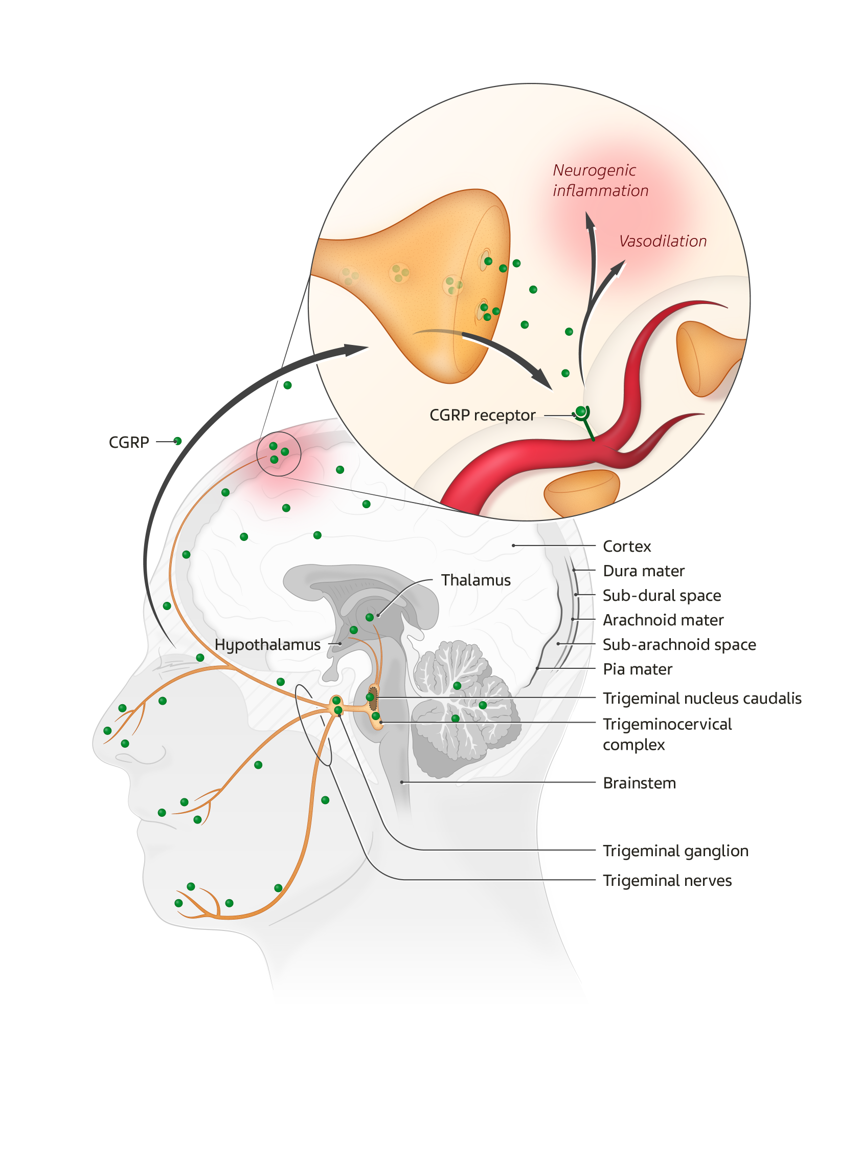 NBUS_Migraine_RepurposedArticle_2020-12_Pathophysiology_MIG-US-NP-00228_IN TEXT FIGURE-808x1080.png